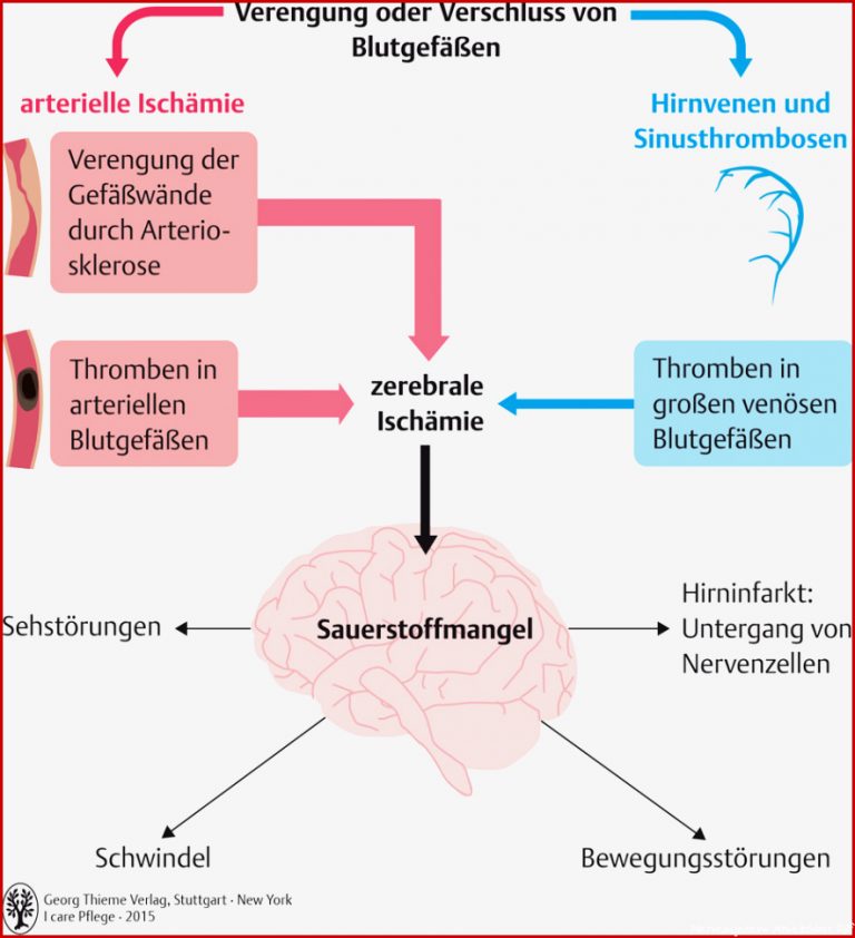 61 Nervensystem Pflegepädagogik Georg Thieme Verlag