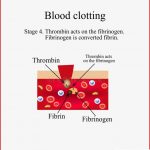 Blutgerinnung Stadium 4 Infographics Auch Im Corel