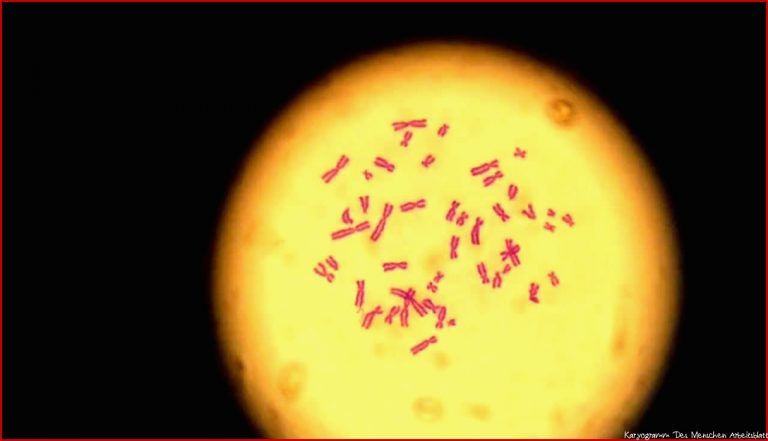 Chromosomen des gesunden Menschen