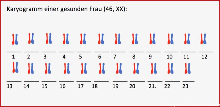 Chromosomen und Karyogramme