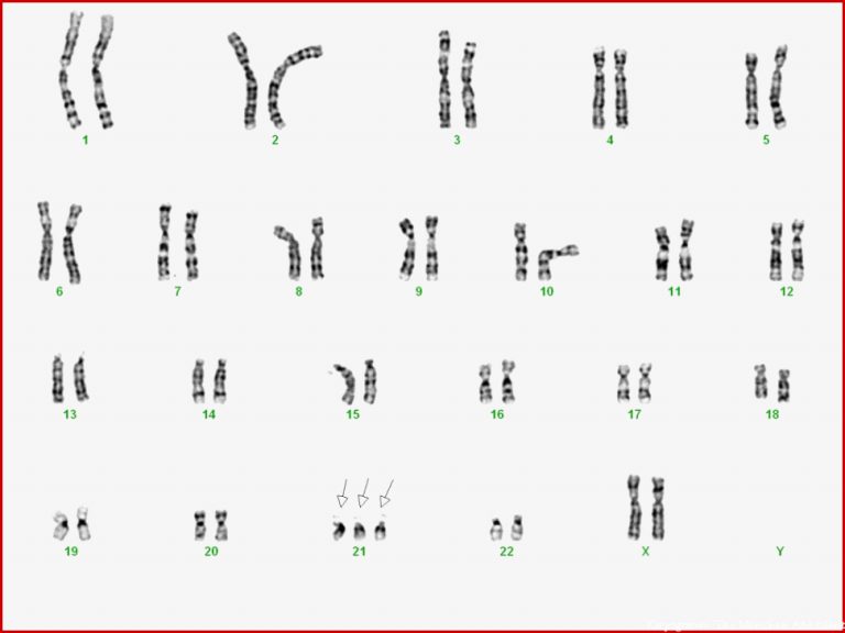 Chromosomenanalysen – allgemeine Informationen – DNA