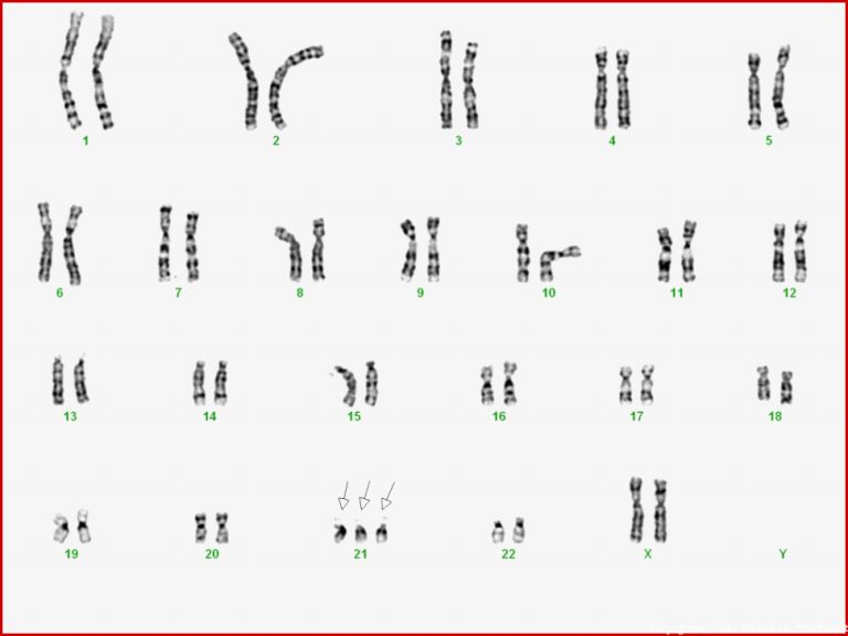 Chromosomenanalysen – Allgemeine Informationen – Dna