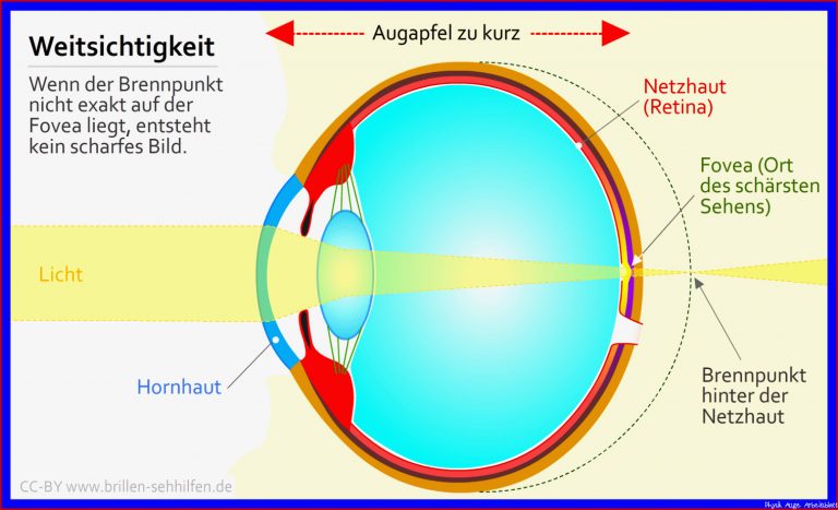 Das Auge Bildentstehung Test 5