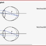 Das Auge Bildentstehung Test 5