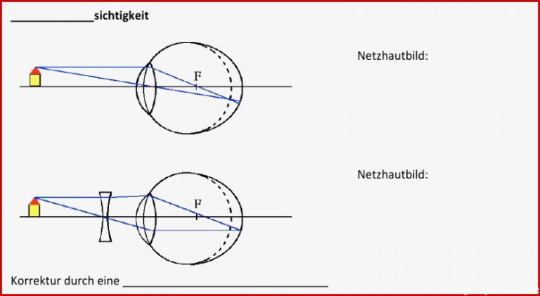 Das Auge Bildentstehung Test 5