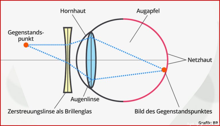 Das Auge Bildentstehung Test 5