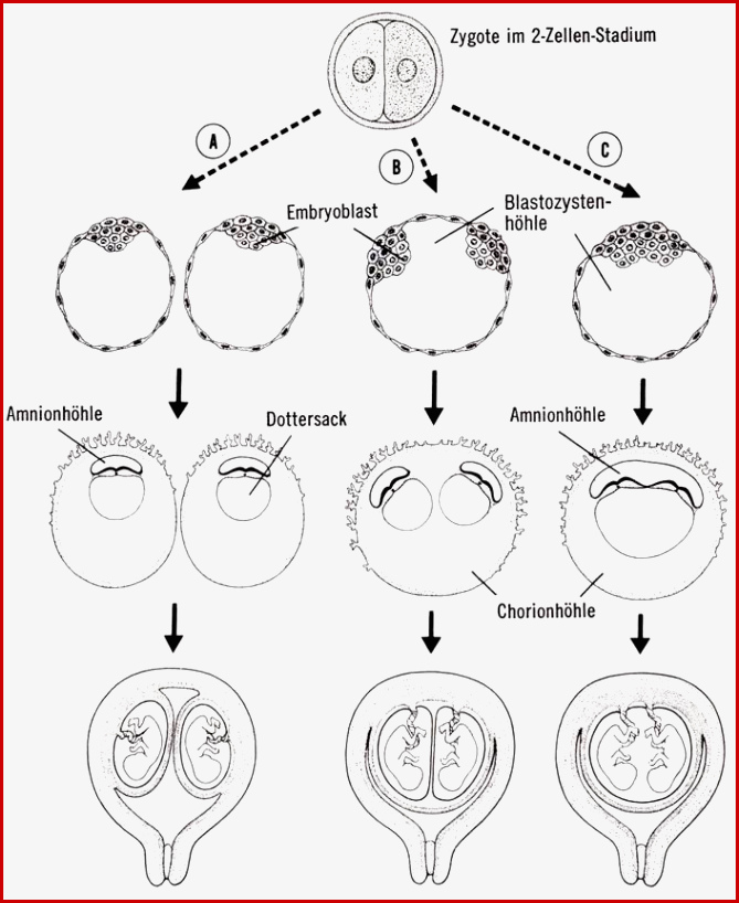 Entstehen Zwillinge