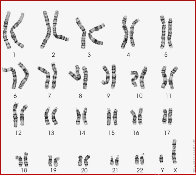 Hilfe bei Bio Hausaufgabe Chromosomen Schule Biologie