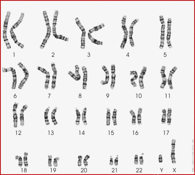 Hilfe Bei Bio Hausaufgabe Chromosomen Schule Biologie