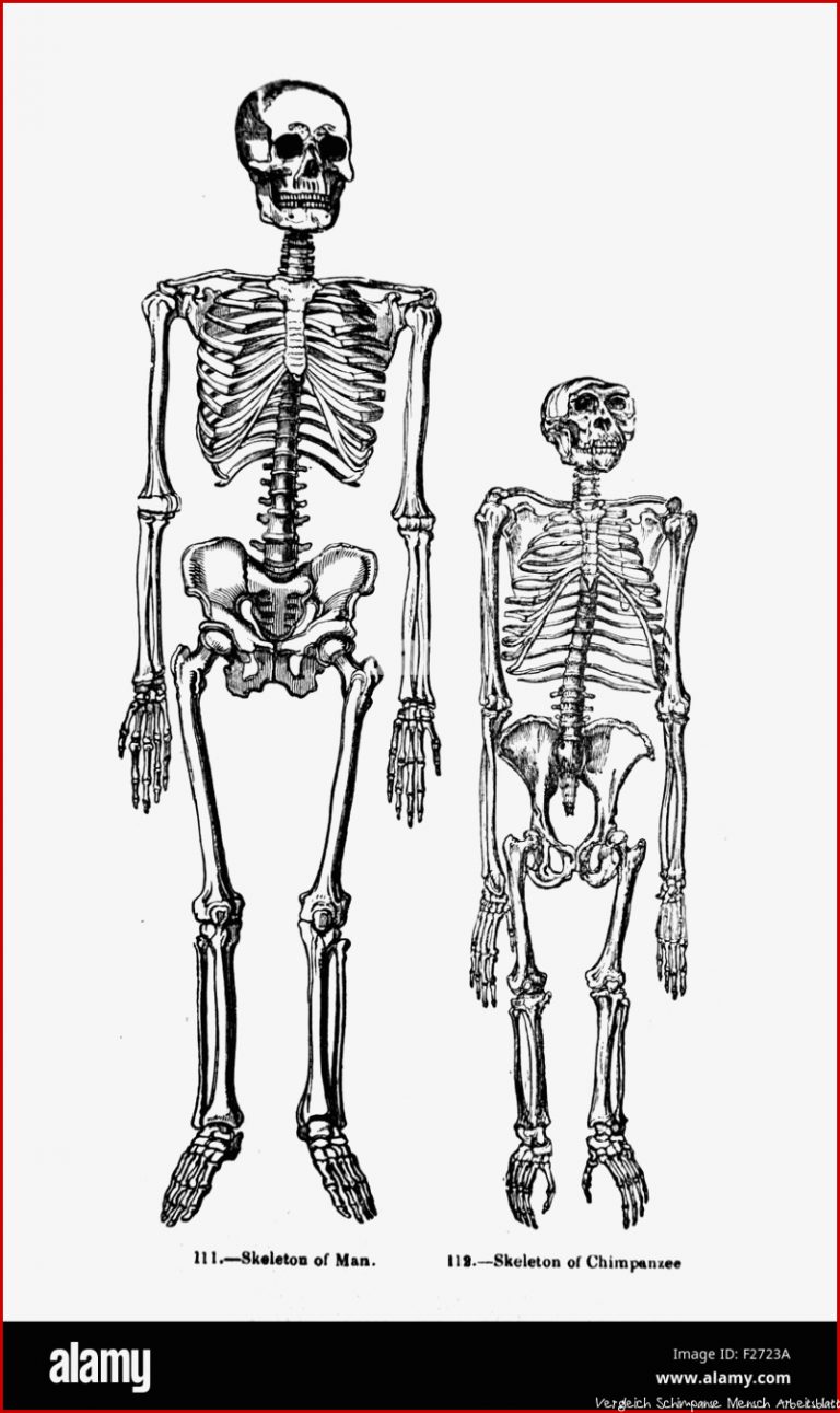 Paraison Des Droits De L Homme Et Des Squelettes De