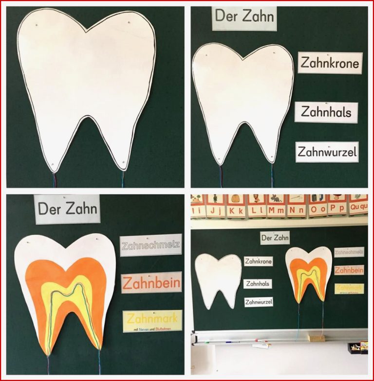 Tafelbild Zum Aufbau Von Einem Zahn Zähne