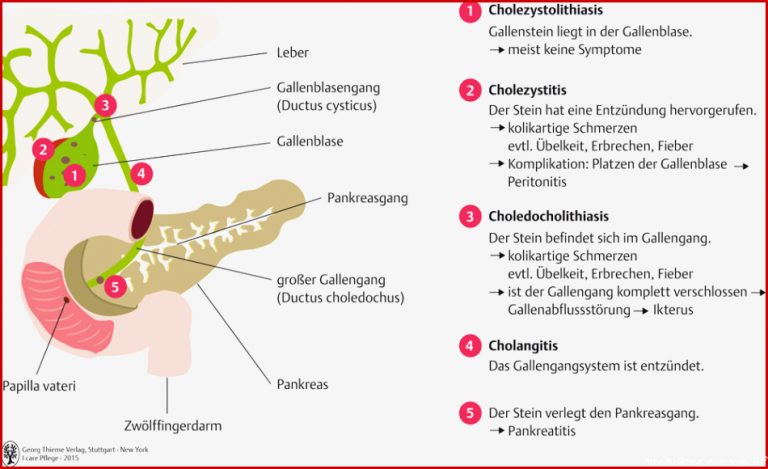 Verdauungssystem Mensch Arbeitsblatt