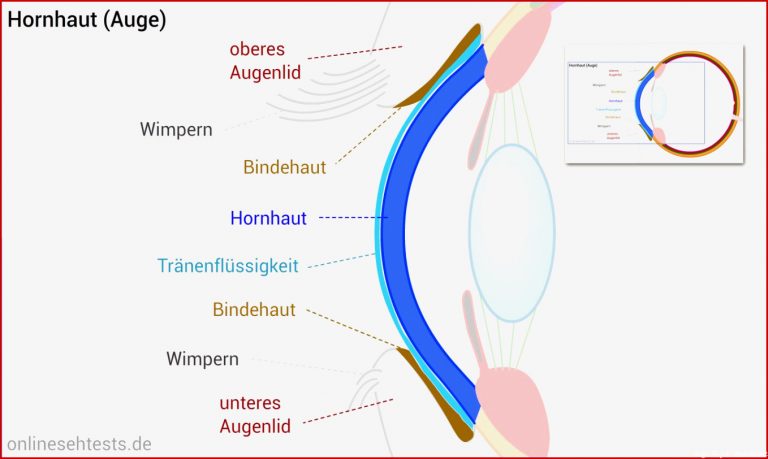 [View 45 ] Skizze Auge Beschriftung