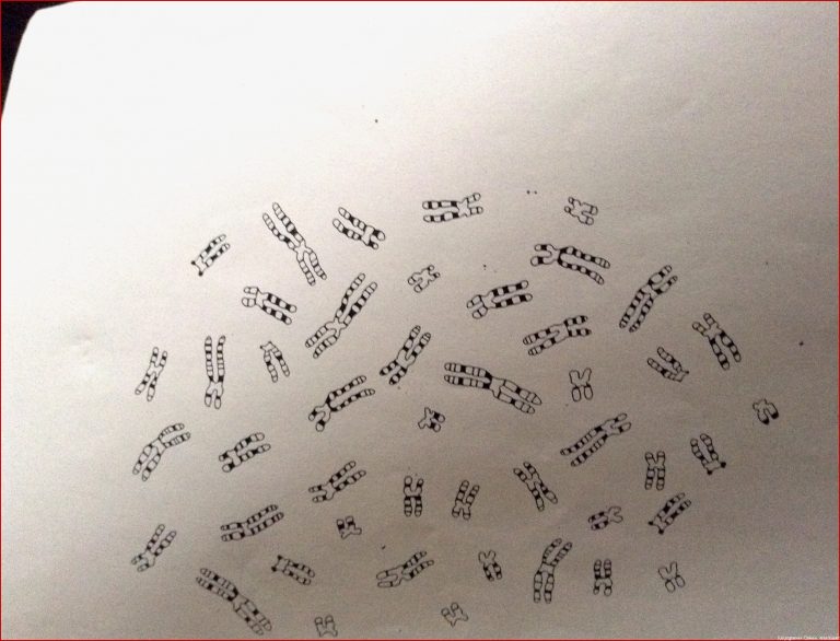 Wie ordne ich chromosomen in einem karyogramm Biologie