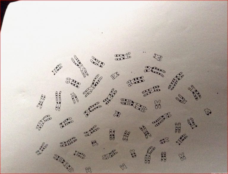 Wie ordne Ich Chromosomen In Einem Karyogramm Biologie