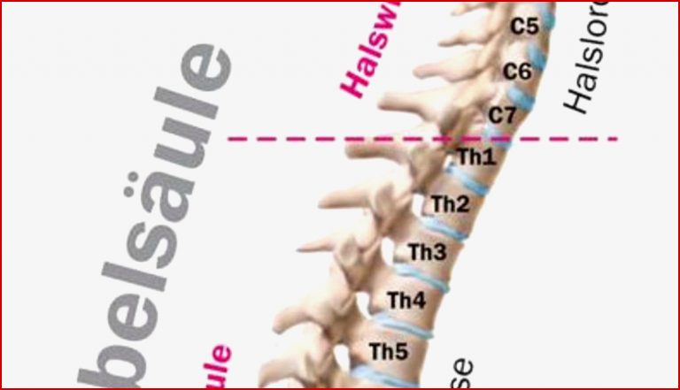 Wirbelsäule Aufbau Und Schwachstellen